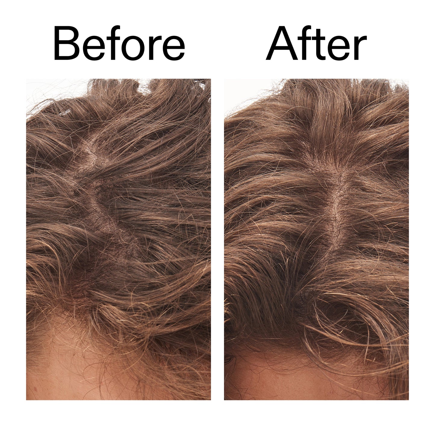 glycolic-acid-exfoliating-scalp-scrub-q8 Glycolic_Acid_Exfoliating_Scalp_Scrub_Before_After_2000x2000_b8561c87-05a1-4caa-80f7-1b6b33d750f7.jpg