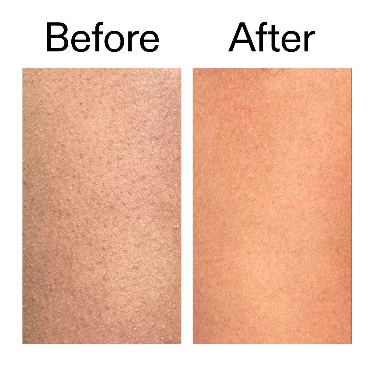 glycolic-acid-exfoliating-body-stick-duo-y3 Glycolic_Body_Stick_B_A_2000x2000_6e6e6b4d-5bd7-43c0-aeed-4d66788e8995.jpg