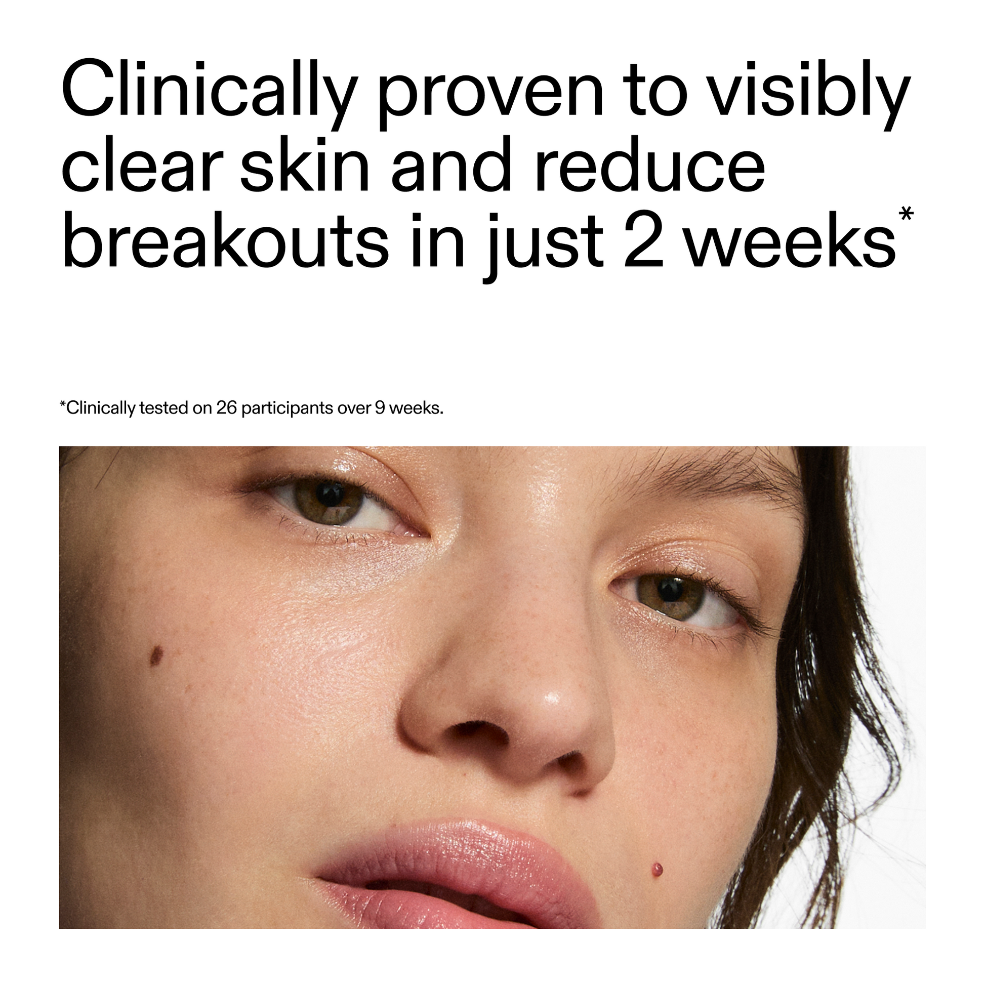 360-acne-clearing-serum-o6 360_Serum_Key_Claim.png