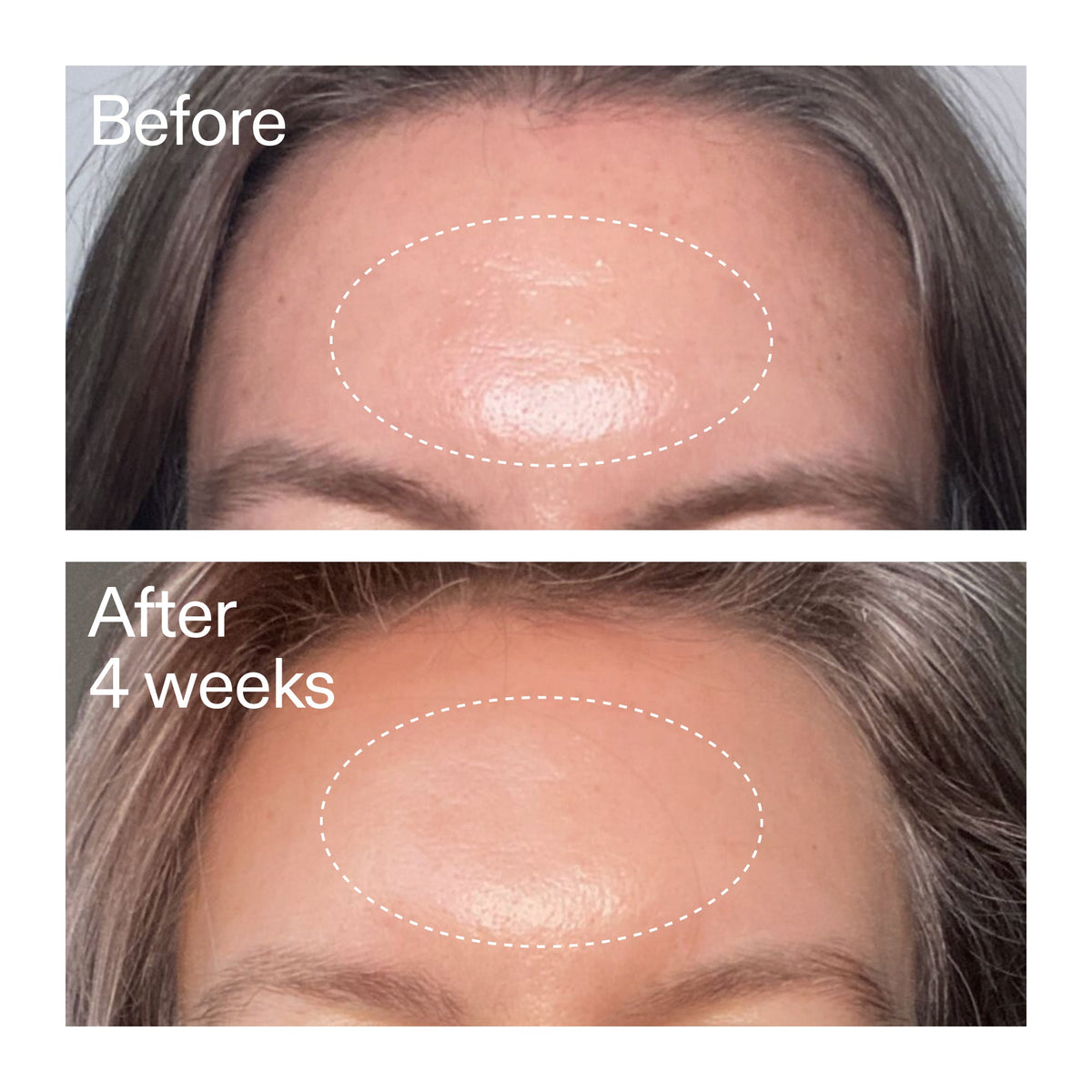 advanced-0-2-retinal-serum-duo-l3 AdvancedRetinal_BeforeAfter1_2000x2000_4e9c798a-f30e-45b8-a34a-7c4740f2f2cb.jpg