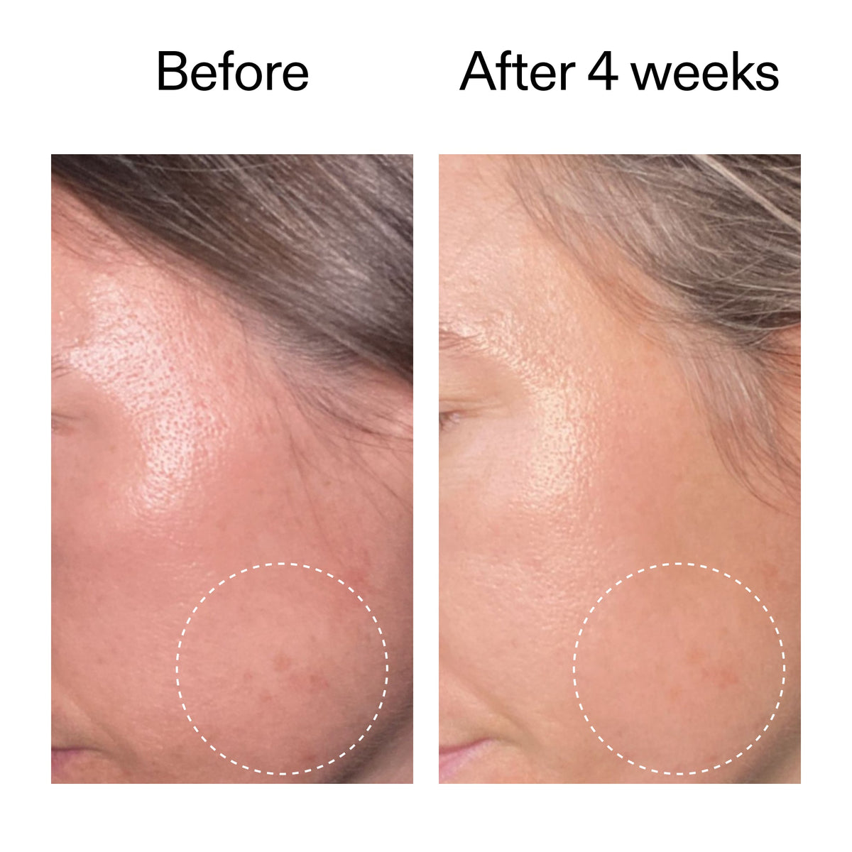 advanced-0-2-retinal-serum-k1 AdvancedRetinal_BeforeAfter2__2000x2000_62fb16bb-77ae-4d63-8500-88dbf847f4b9.jpg