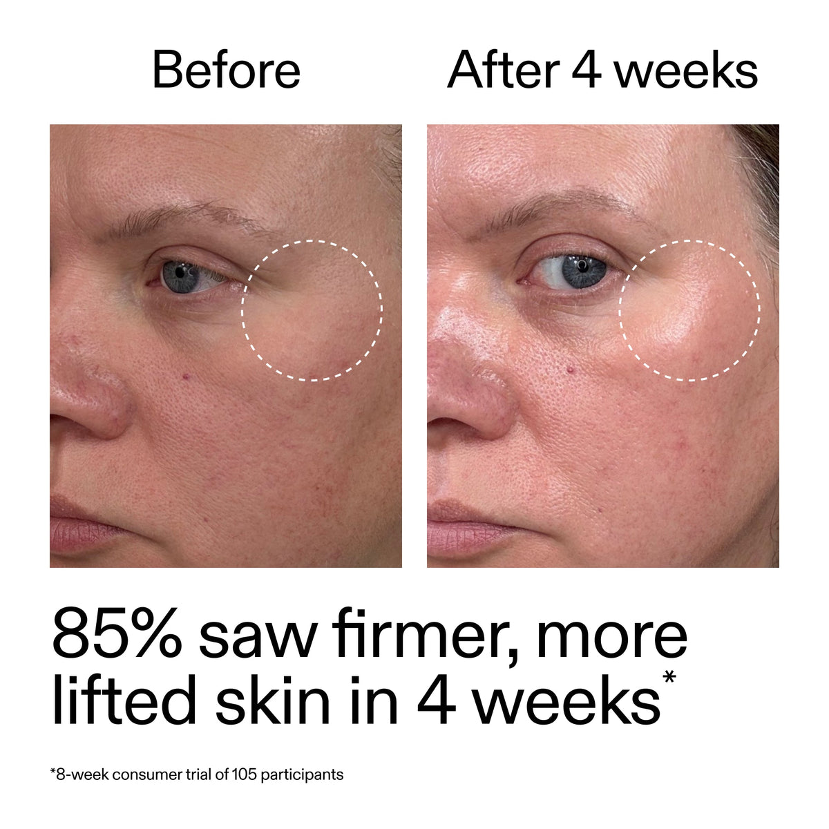 advanced-0-2-retinal-serum-duo-l3 AdvancedRetinal_BeforeAfter_Claim1_2000x2000_3a315aa8-f408-4b33-bbeb-0d9209f98404.jpg