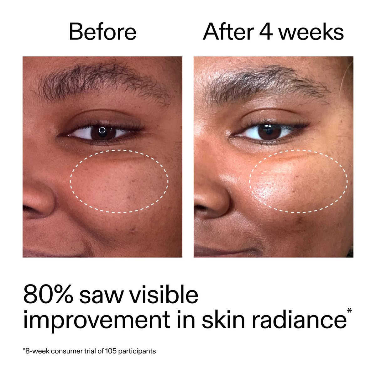 advanced-0-2-retinal-serum-duo-l3 AdvancedRetinal_BeforeAfter_Claim2_2000x2000_681b621d-8d44-4d44-9a40-89244f9b2e53.jpg