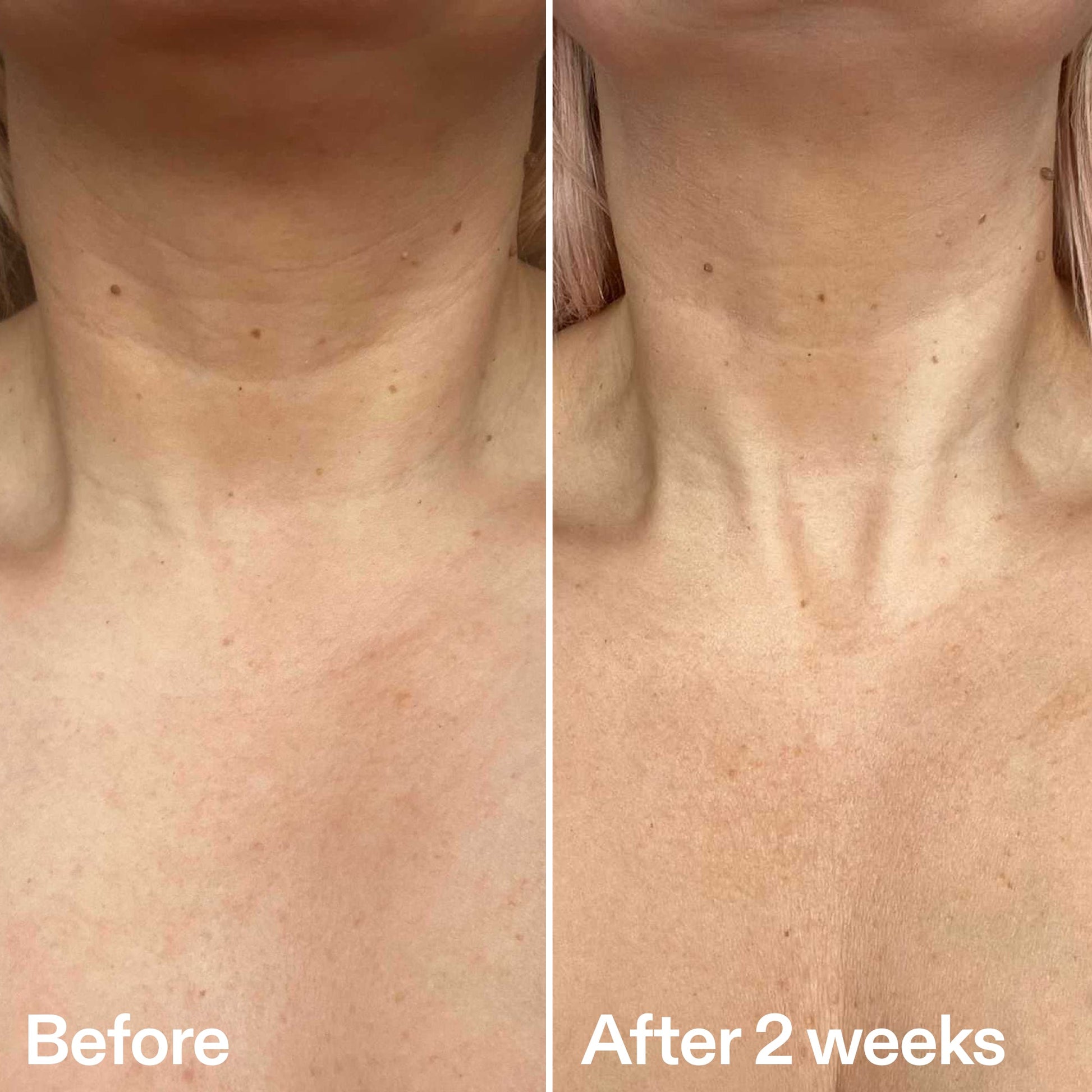 bio-active-neck-lift-stick-r8 B_A_2.jpg