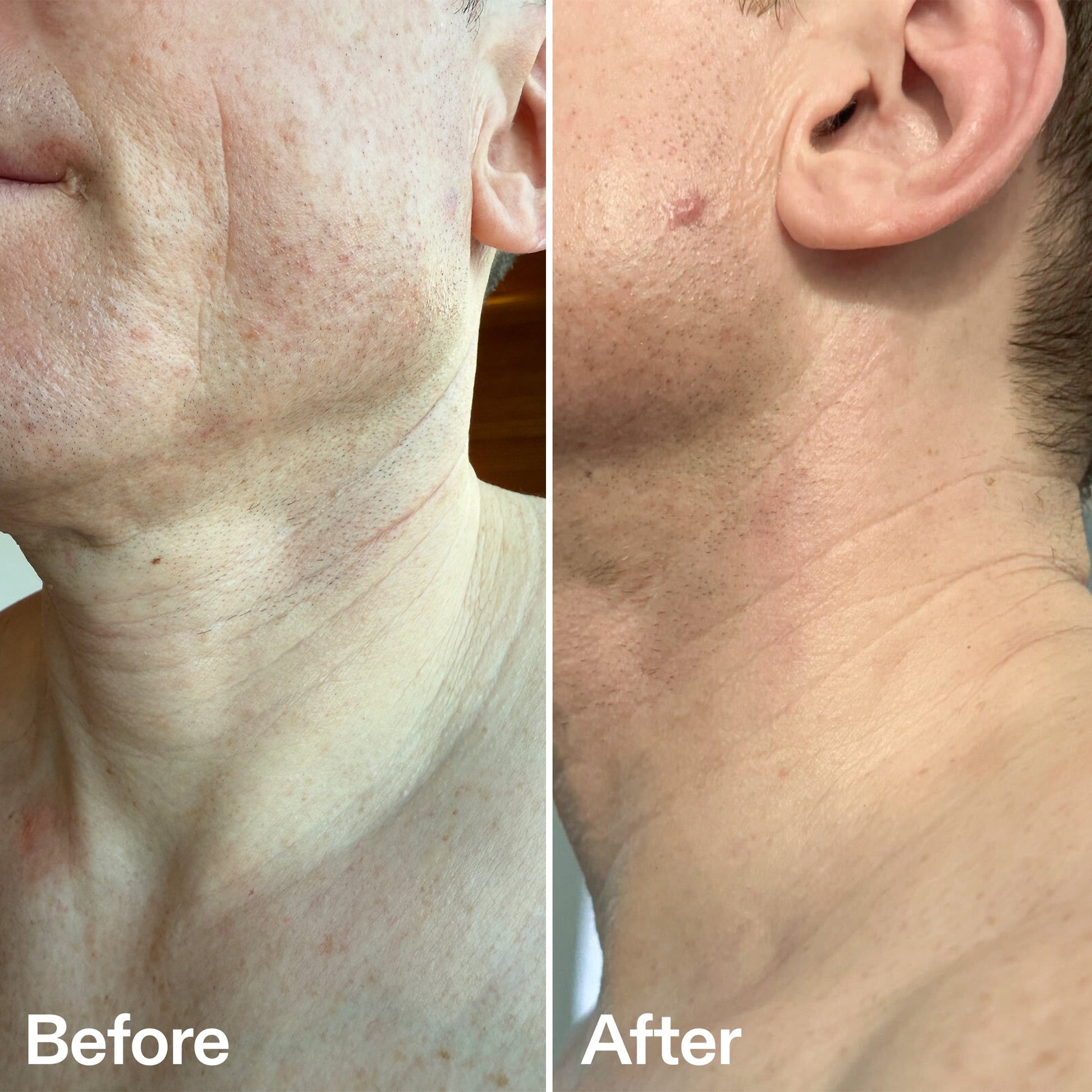 bio-active-neck-lift-stick-r8 B_A_afa2743e-b8e2-4504-92f4-e281cb6cf759.jpg