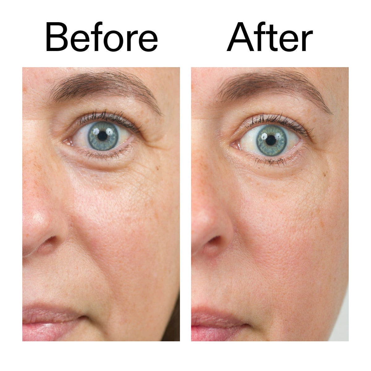bio-active-ceramide-moisturizer-duo-q9 Bio-Active_Before_After_2000x2000_566e5a9e-135e-417a-8242-b44e5fa35463.jpg