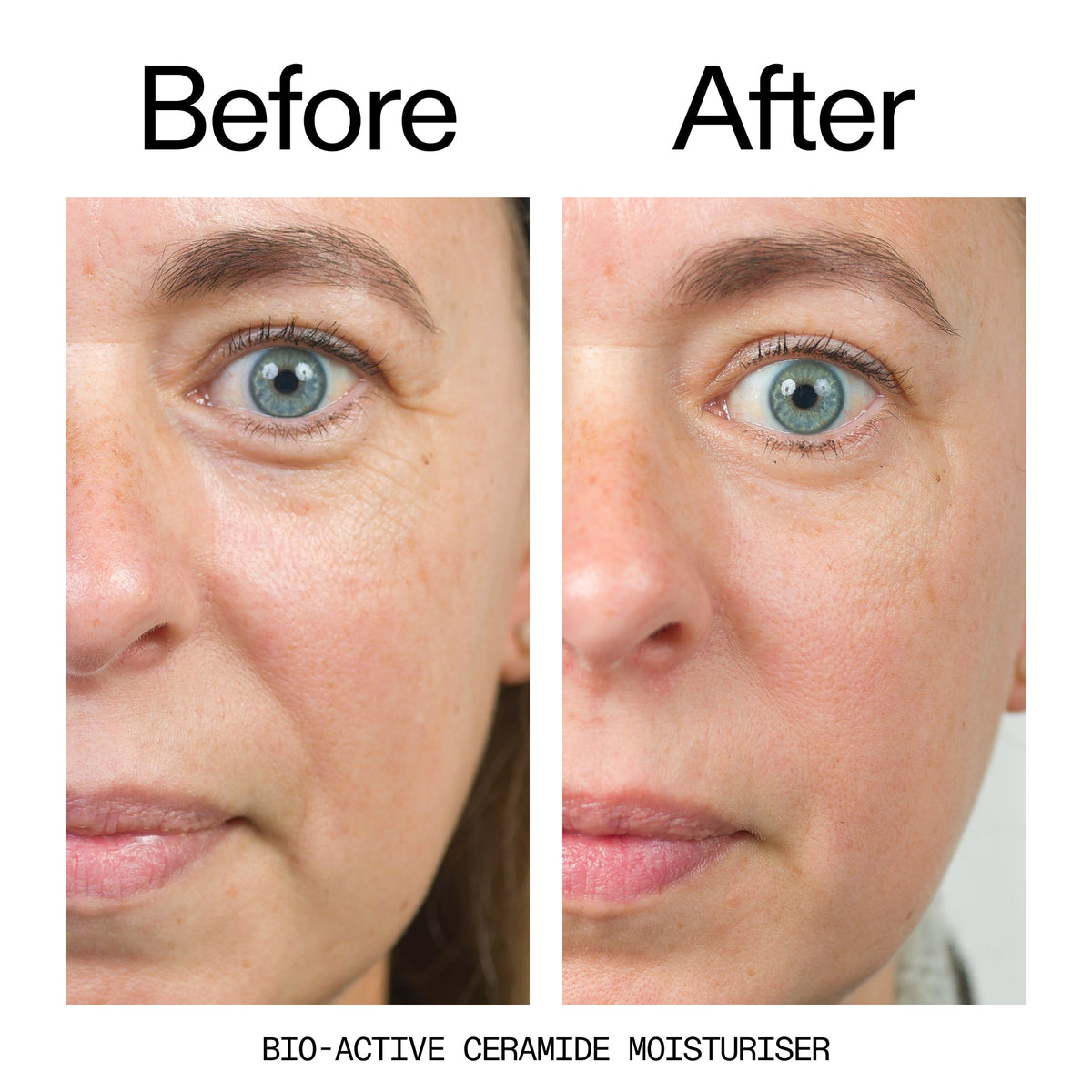barrier-boosting-trio-h3 Bio-Active_Before_After_2000x2000_600947b4-e8c5-425a-9155-fc15bc83aa12.jpg
