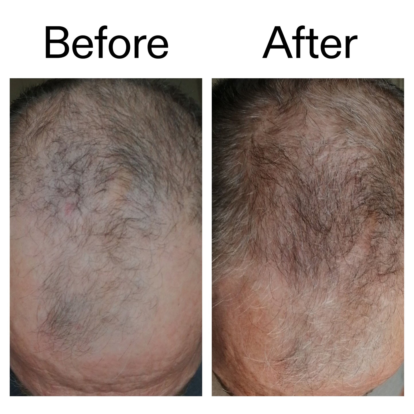 3-month-hair-growth-trio-n5 Caffeine_Scalp_Treatment_B_A_Ppage_2000_x_2000.jpg