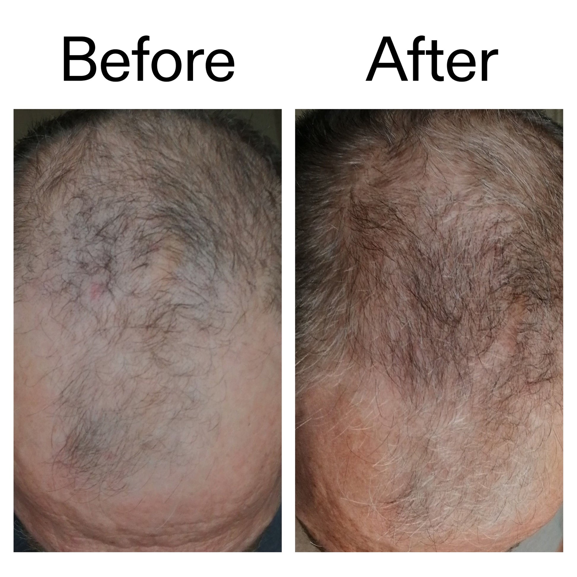 3-month-hair-growth-trio-n5 Caffeine_Scalp_Treatment_B_A_Ppage_2000_x_2000.jpg