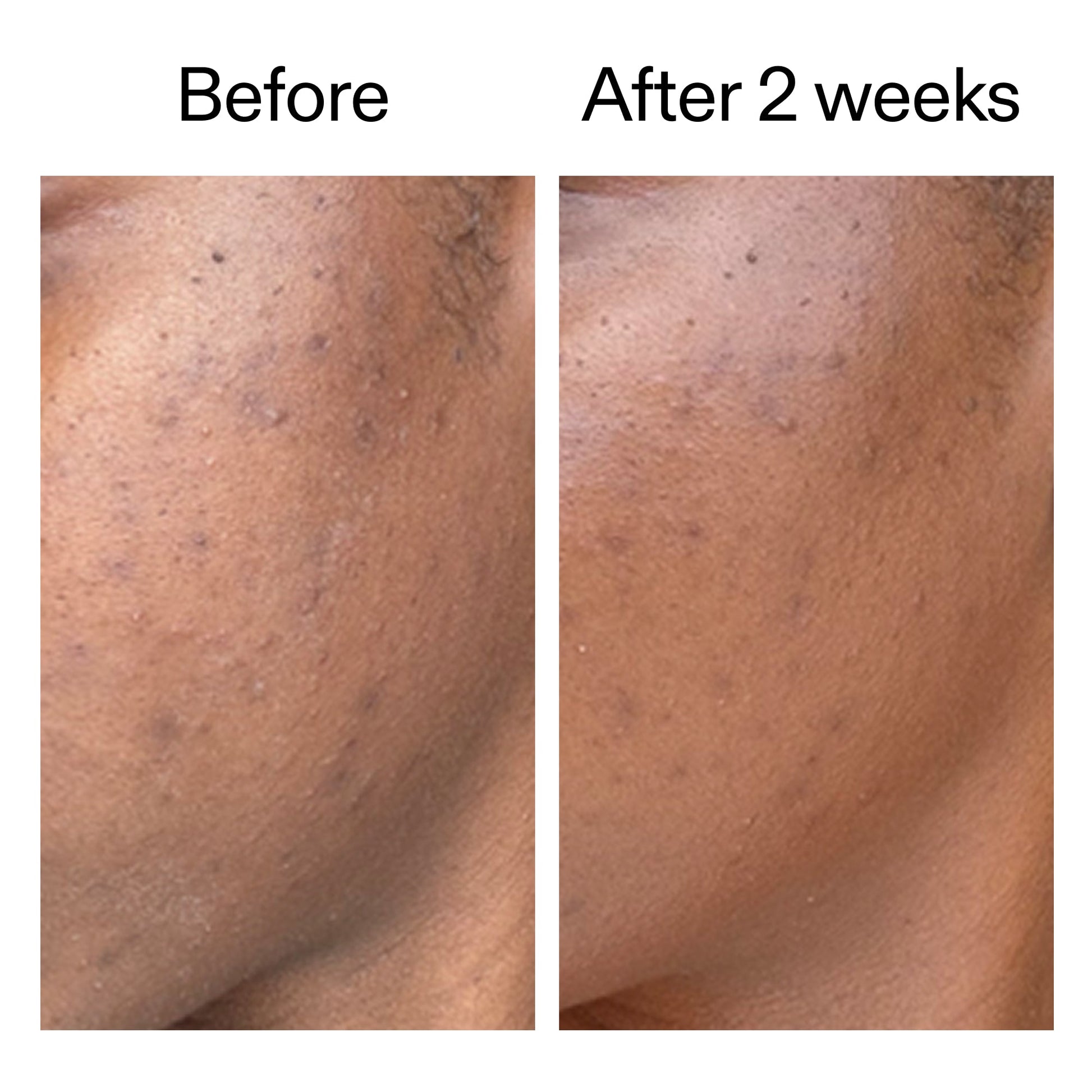 360-acne-clearing-serum-o6 DIOICB_A2000x2000.jpg