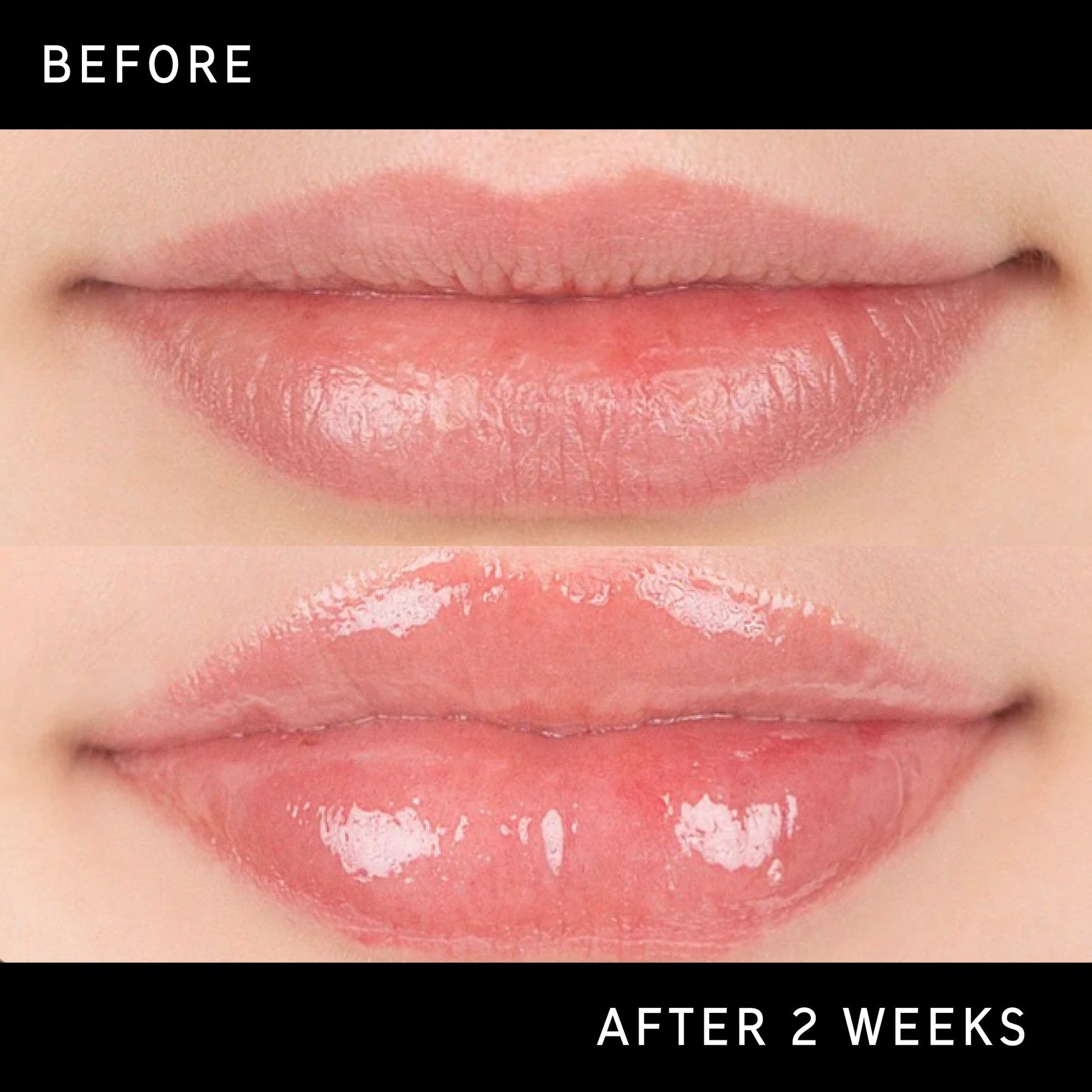 lip-plumping-duo-y9 DTC-Top15_Amends_Tripeptide-Lip_B_A.jpg
