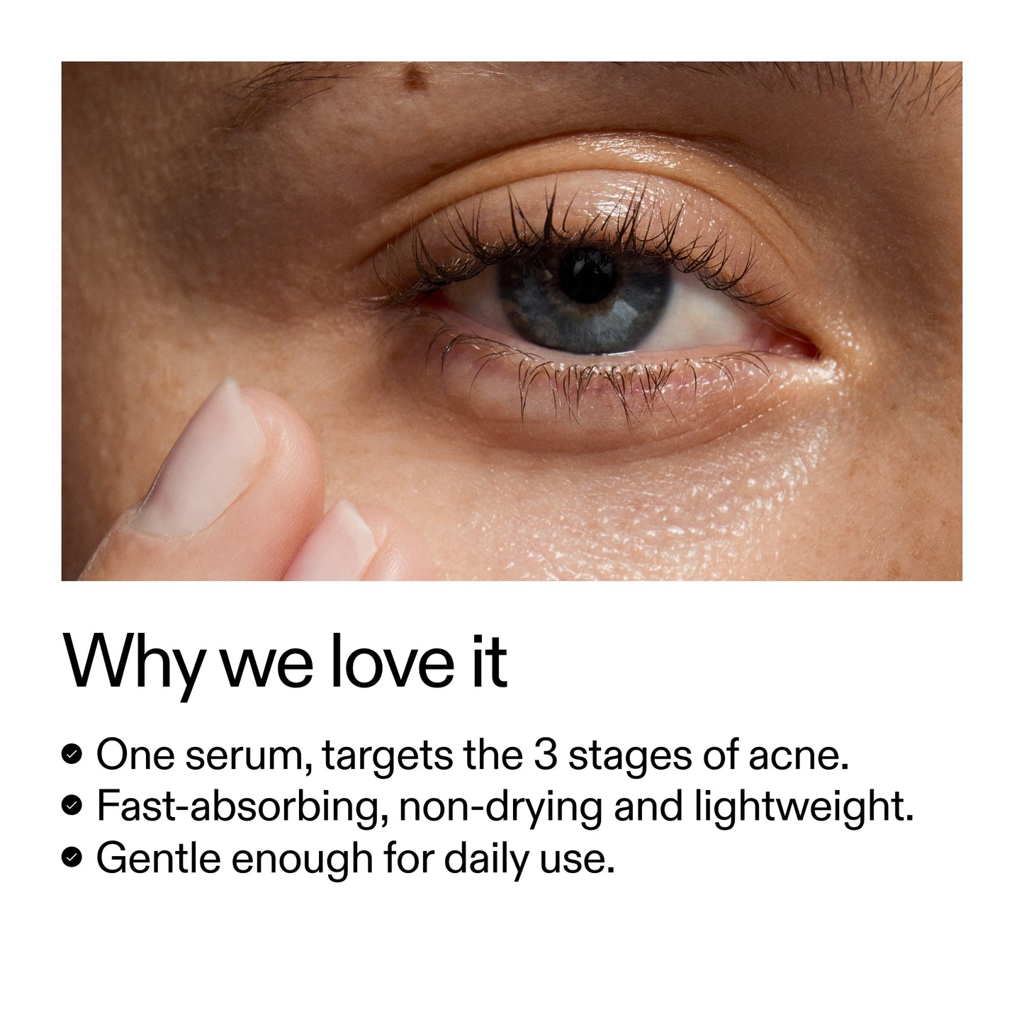 360-acne-clearing-duo-r7 Dioic_Whyweloveit_2000x2000_175aafd3-0cbe-403a-b317-a8362881bfe2.jpg