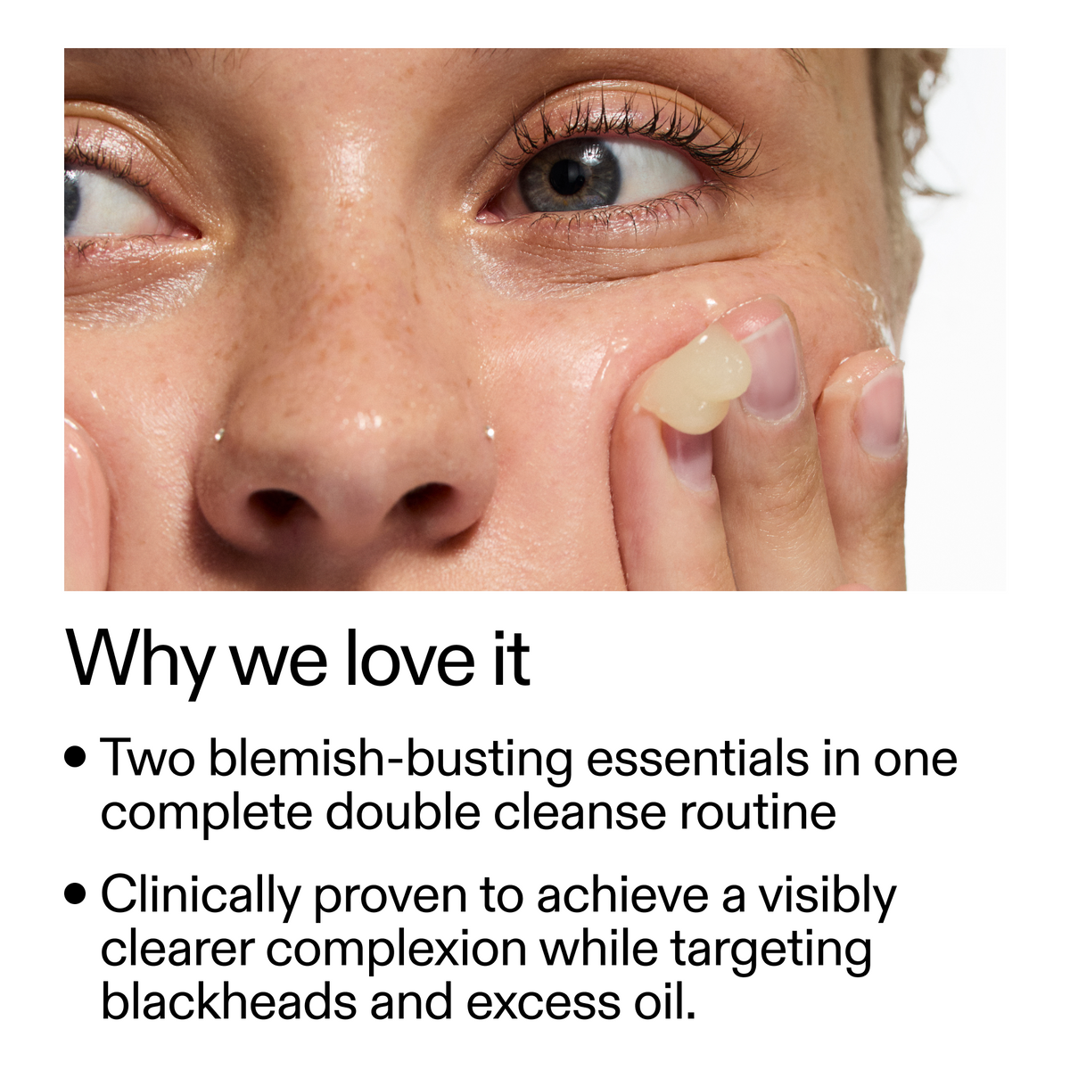 acne-double-cleanse-duo-a7 Double_Cleanse_Duo_for_Breakouts_Why_We_2000x2000_f242cb12-bb5c-487c-b203-071ccb406ec5.png