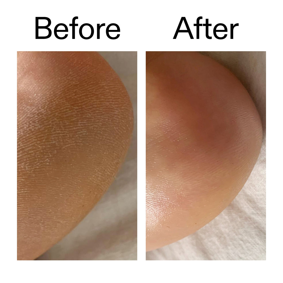 glycolic-acid-exfoliating-body-stick-duo-y3 Glycolic_Acid_Exfoliating_Body_Stick_Before_After_V1_2000x2000_a3043625-9400-429a-a7fb-d6dbd220f722.jpg