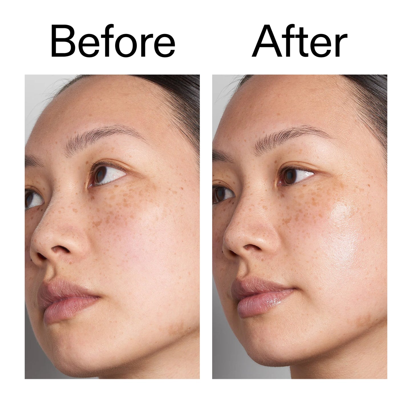 supersize-hyaluronic-acid-serum-100ml-c1 Hyaluronic_Acid_Before_After_2000x2000_d7983956-8aa2-4ea3-8255-c63e8d4f892e.jpg