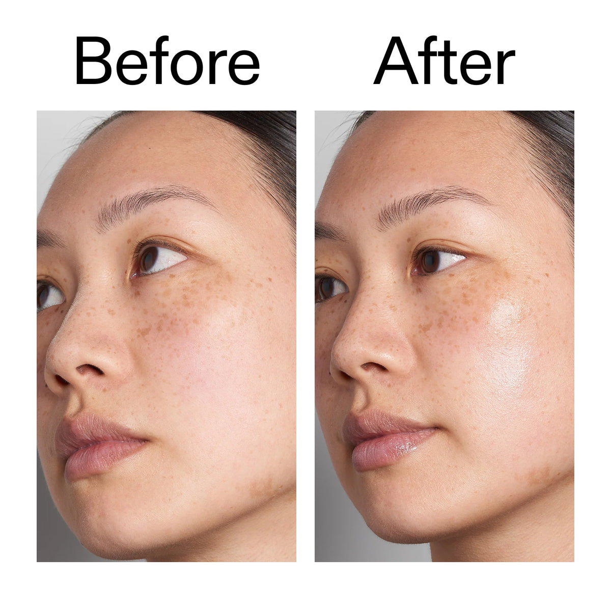 supersize-hyaluronic-acid-serum-100ml-duo-j1 Hyaluronic_Acid_Before_After_2000x2000_d7983956-8aa2-4ea3-8255-c63e8d4f892e.jpg