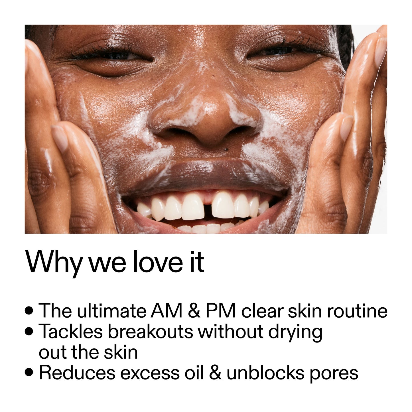 intro-routine-for-acne-w4 Intro_Routine_for_Acne_Why_we_love_it_2000x2000_42499e10-4629-4a0e-a627-7e215f4da6bc.jpg