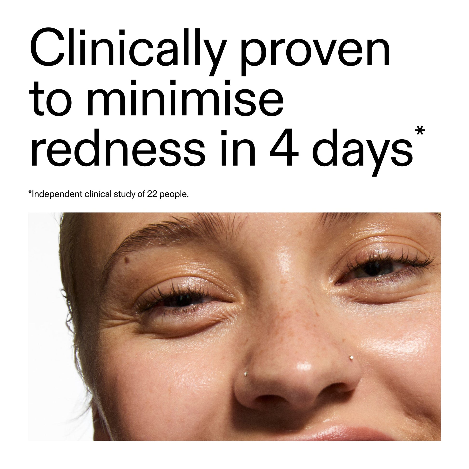 10-azelaic-acid-serum-for-redness-relief-p0 Oat_Cleansing_Balm_Claim_2000x2000_52a841dc-353c-4f2c-8646-3aadb604507d.jpg