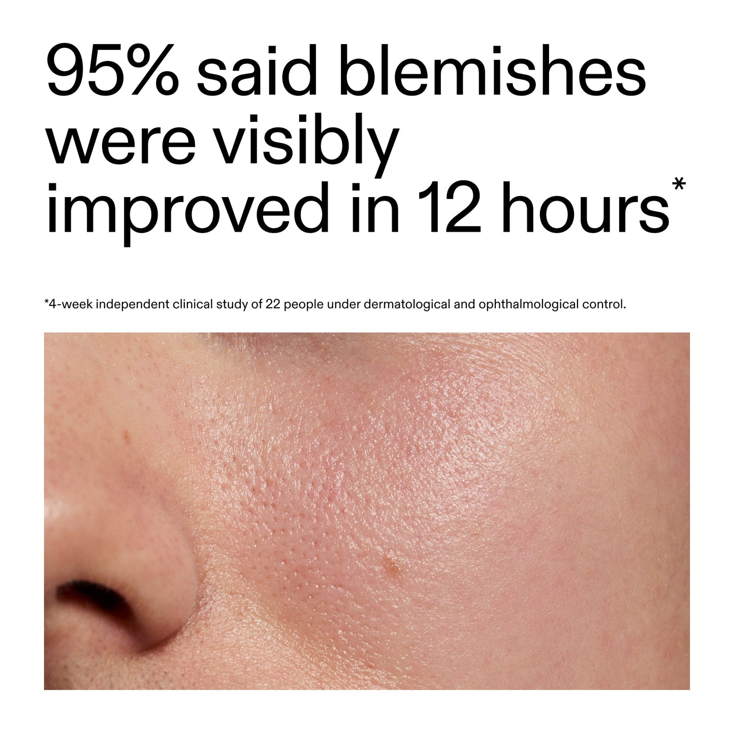 succinic-acid-acne-treatment-g8 Oat_Cleansing_Balm_Claim_2000x2000_ac6ce553-25db-41b2-a981-faae1ac4b8c0.jpg