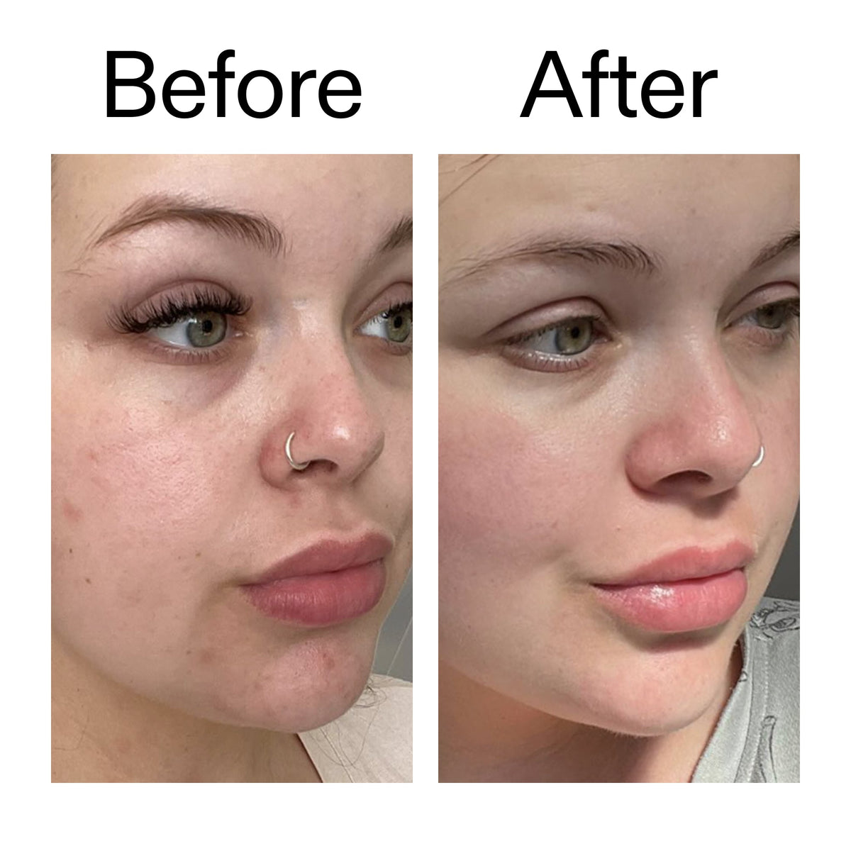 supersize-omega-water-cream-duo-u4 Omega50_Before_After_2000x2000_46483ed8-3f9d-487f-9a0c-9df79830bd65.jpg