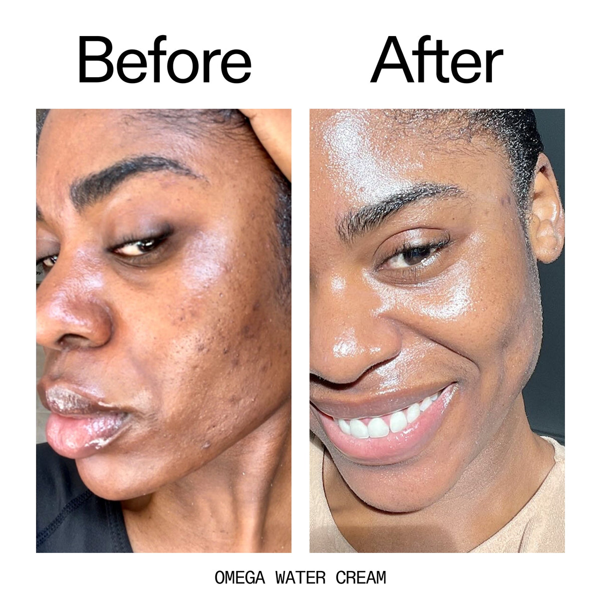 hydrating-cleanser-and-moisturizer-duo-g6 Omega_Water_Cream_Before_After_2000x2000_8e88278b-8c8d-48dc-ac77-4e98ebbd1b77.jpg