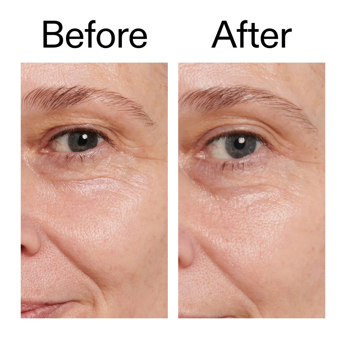 retinol-eye-cream-g7 Retinol_Eye_Cream_Before_After_2000x2000_ac03a80c-109e-4572-a95a-91dc109b4d27.jpg