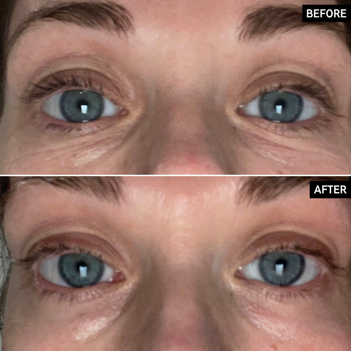 retinol-eye-cream-z3 SITE-UGCBAsApril_Nicole_B_A_PPage_2000x2000_1.jpg