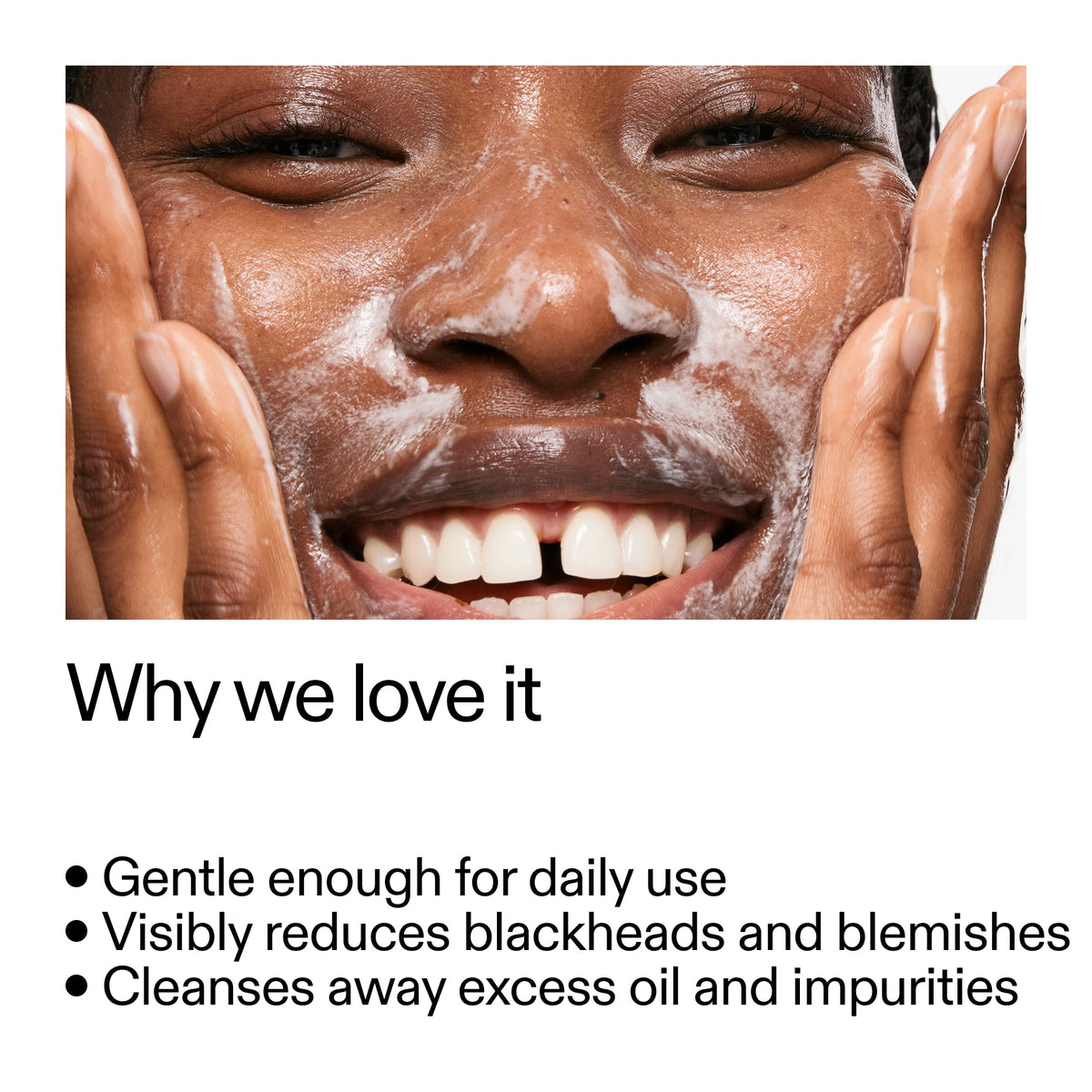salicylic-acid-cleanser-duo-c8 Salicylic_Acid_Cleanser_-_300mlWhy_we_love_it_2000x2000_87dc92a9-2559-4309-98cd-4e570f1be735.jpg