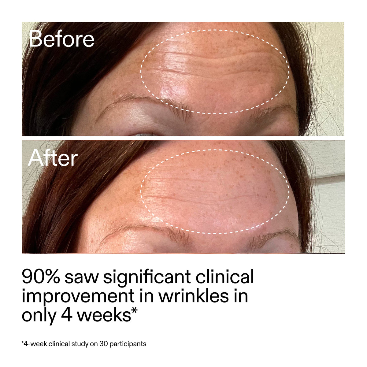 starter-retinol-serum-duo-g3 StarterRetinol_BeforeAfter_Claim1_2000x2000_03b4d6e5-a357-43b9-a855-aba5e35c57f3.jpg