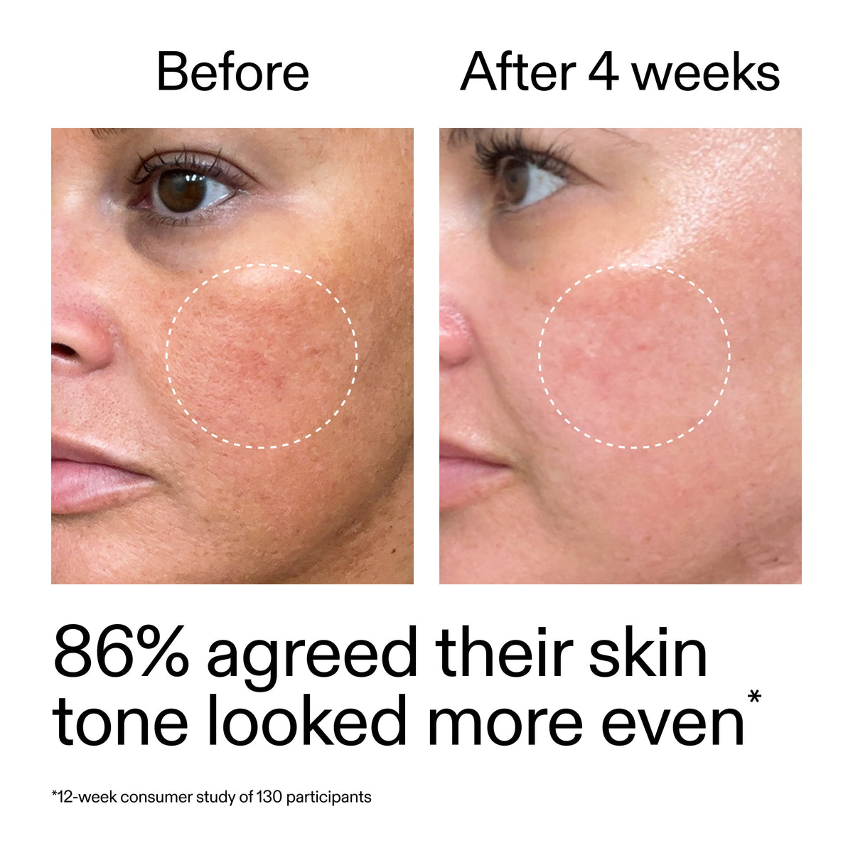 starter-retinol-serum-duo-g3 StarterRetinol_BeforeAfter_Claim2_2000x2000_fc5bb8ac-8588-478f-98d5-28af6651601a.jpg