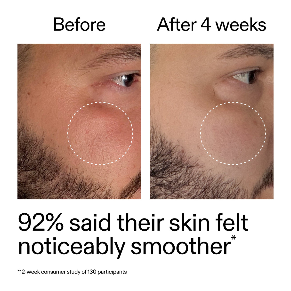 starter-retinol-serum-duo-g3 StarterRetinol_BeforeAfter_Claim3_2000x2000_458243a8-bbb0-4e5d-a274-29c7766d339b.jpg