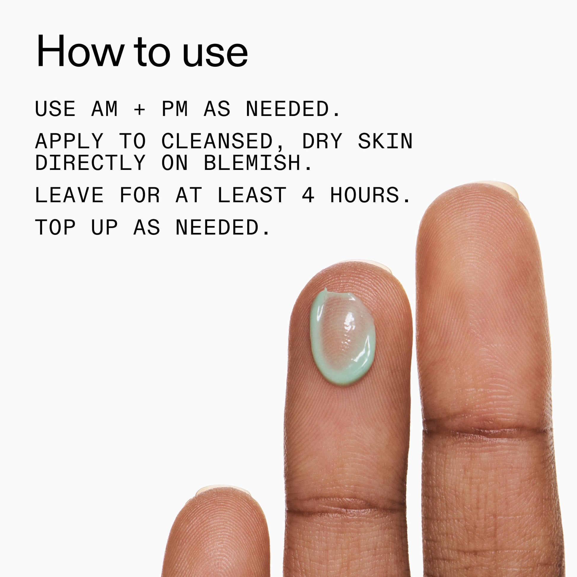 succinic-acid-acne-treatment-g8 Succinic_Acid_Treatment_How_to_Use_2000x2000_d57137d5-d7f1-427c-9a46-5fc00c19c542.jpg