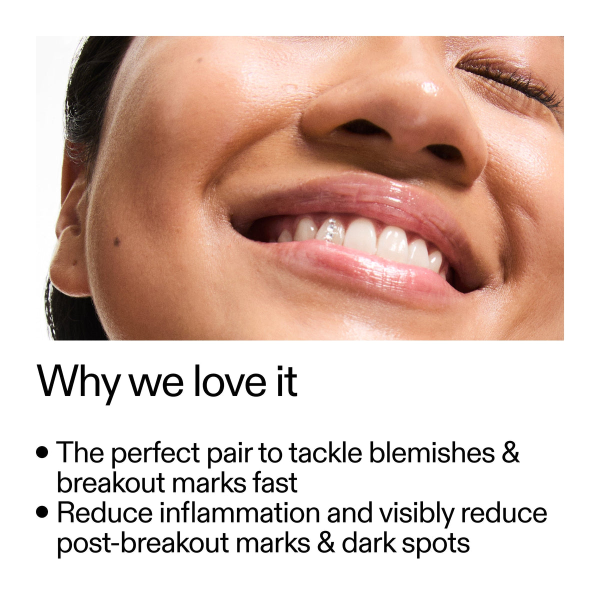 targeted-blemish-duo-u9 Targeted_Blemish_Duo_Why_we_love_it_2000x2000_ff00be46-438b-485f-b5c3-91e60bbb6919.jpg