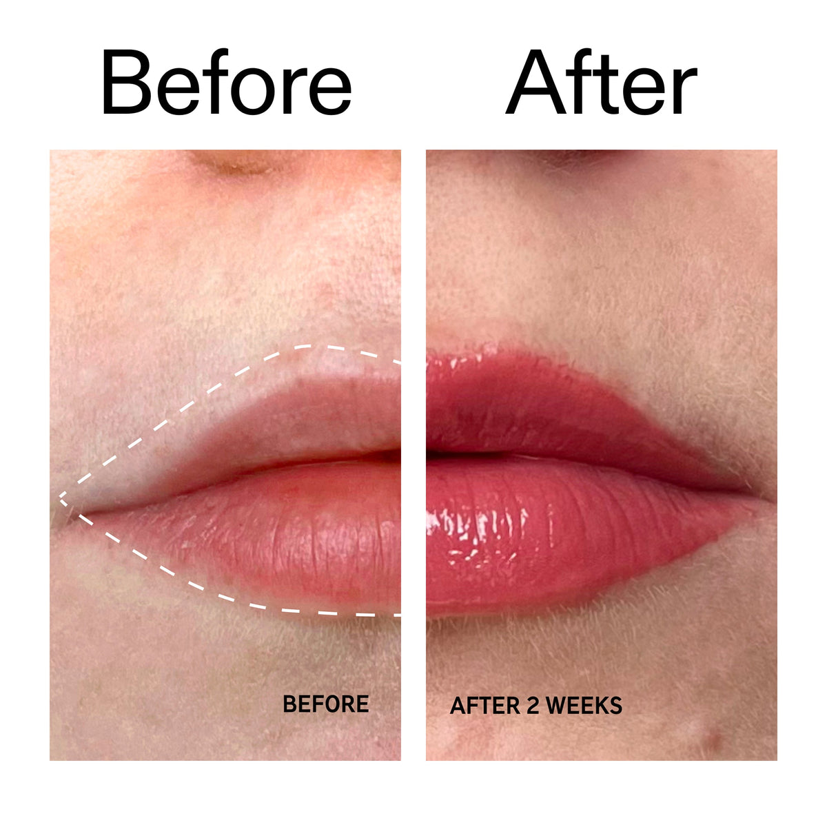 tripeptide-plumping-berry-lip-balm-s6 Tripeptide_Plumping_Lip_Balm_-_Berry_Before_After_2000x2000_9474bbd8-43ca-4b0e-b0e7-dfab70b91927.jpg