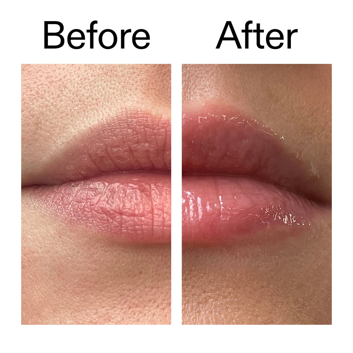 tripeptide-plumping-lip-balm-m2 Tripeptide_Plumping_Lip_Balm_Before_After_2000x2000_b4a5ee04-d2ac-4857-8f01-17209acc4bf3.jpg
