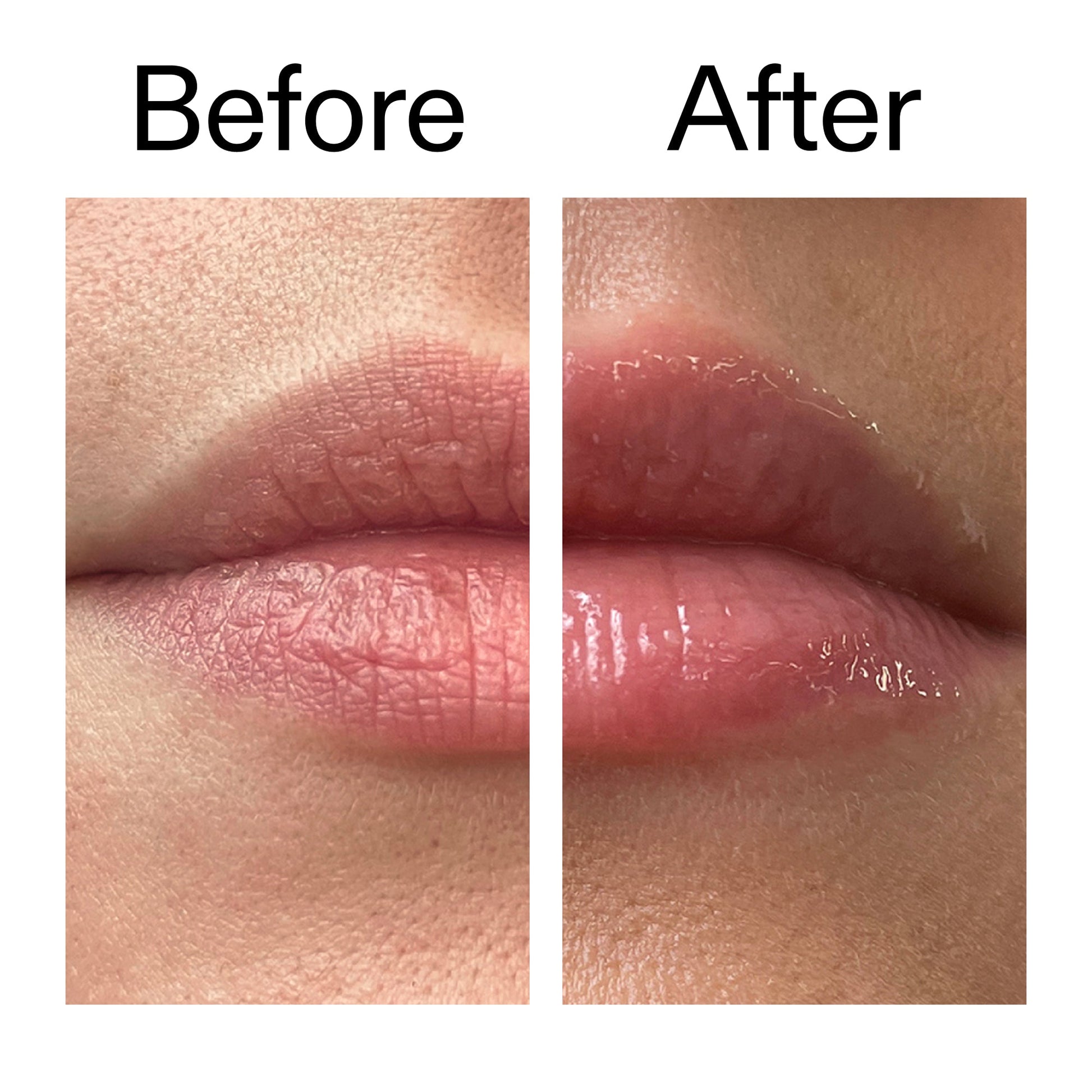 lip-plumping-duo-y9 Tripeptide_Plumping_Lip_Balm_Before_After_2000x2000_b4a5ee04-d2ac-4857-8f01-17209acc4bf3.jpg
