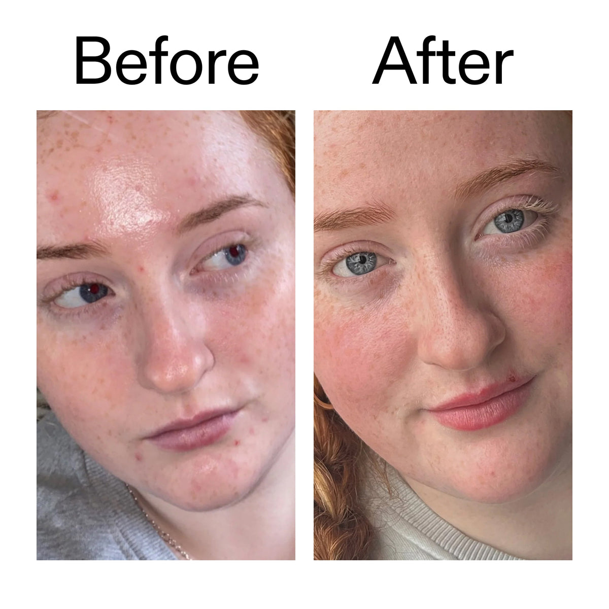 vitamin-b-c-and-e-moisturizer-z0 Vitamin_B_C_and_E_Moisturizer_Before_After_2000x2000_b0781a76-5ad2-4be9-95b8-ef92b356833c.jpg